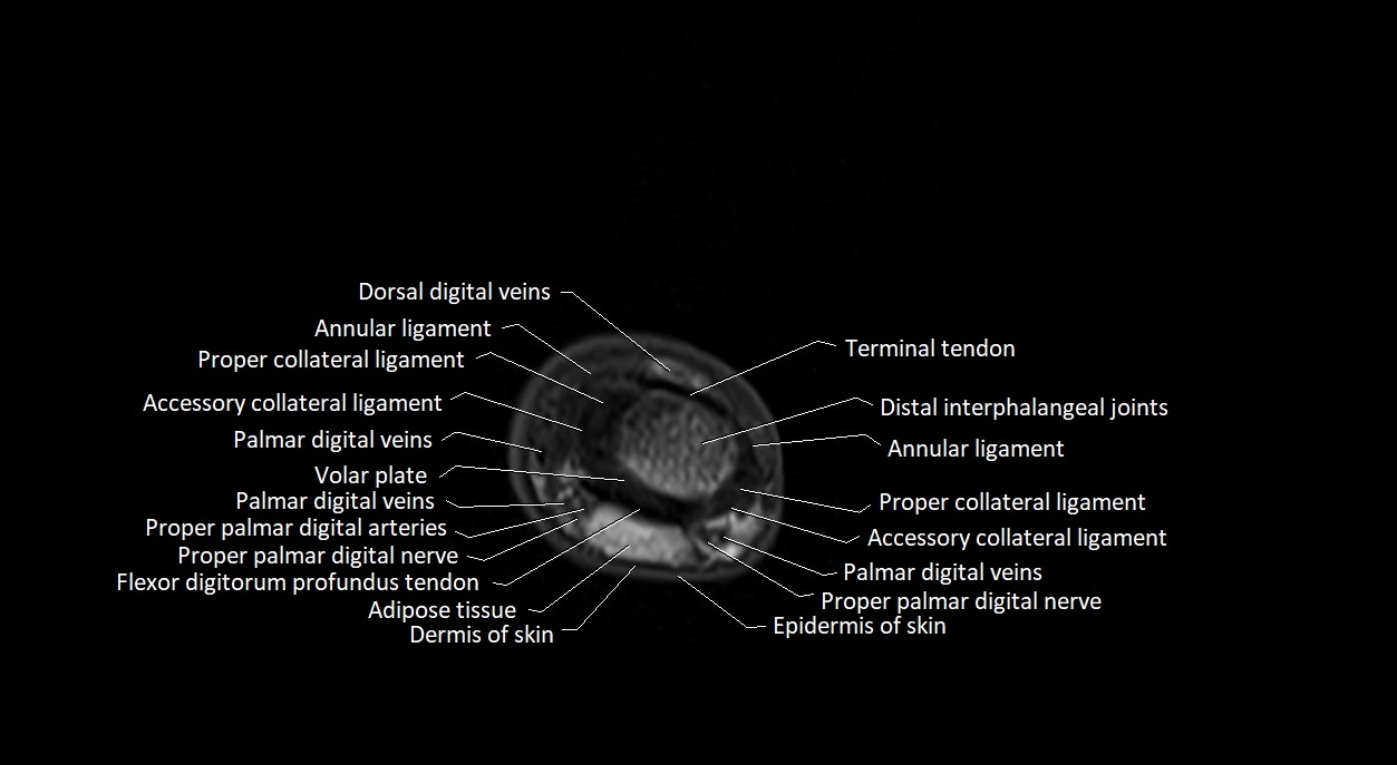 Finger anatomy axial cross sectional 3T image image 6.webp
